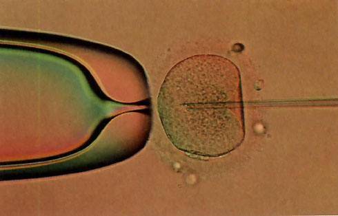 重庆借卵生殖中心:流产需要多长时间才能自然发生？